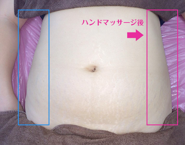 痩身のハンドマッサージ