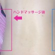 痩身のハンドマッサージ