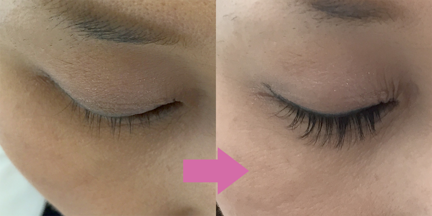 img_beforeafter