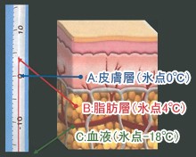 脂肪冷却痩身で痩せるメカニズムはクライオリポライシス理論にある！