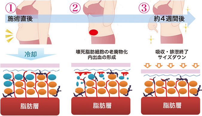 効果が生まれるまでの流れとは